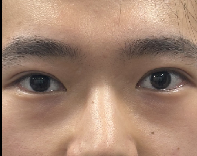 After
