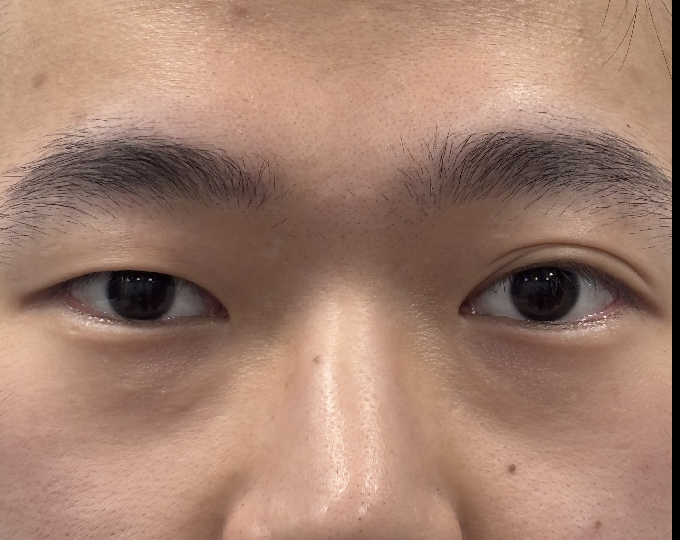 Before
