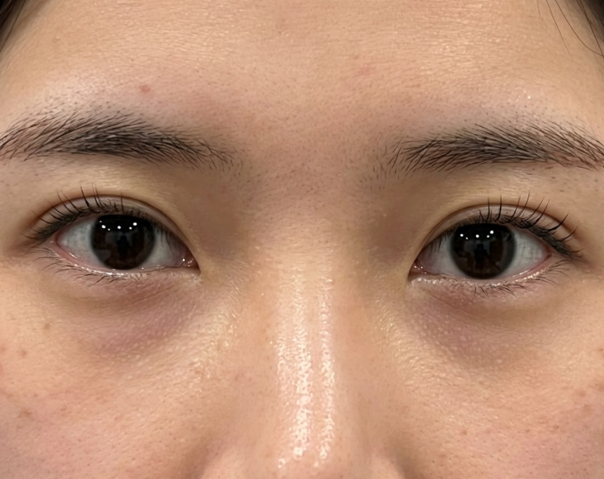 After