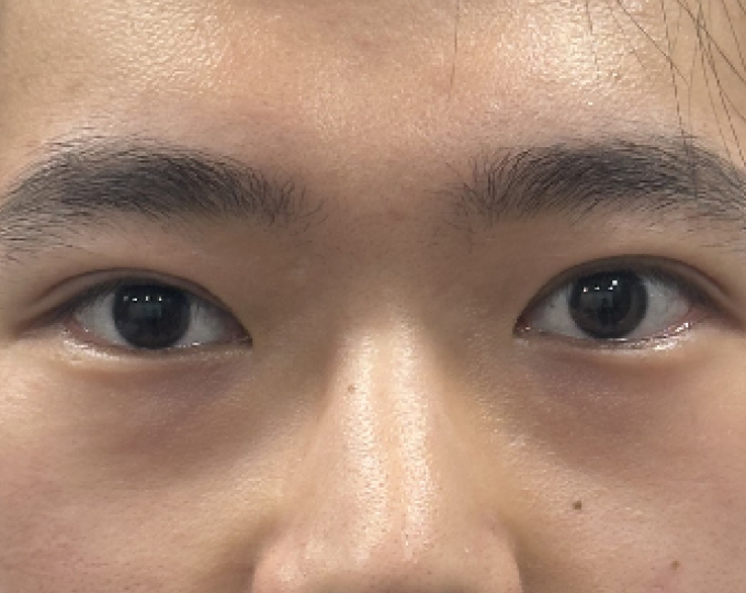 After