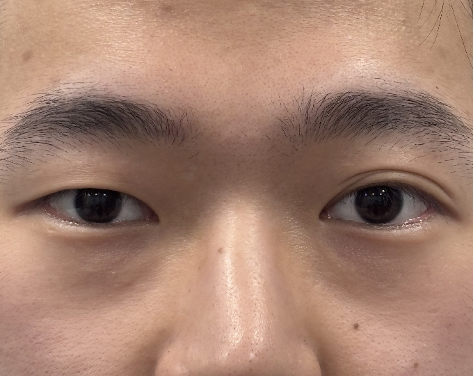Before