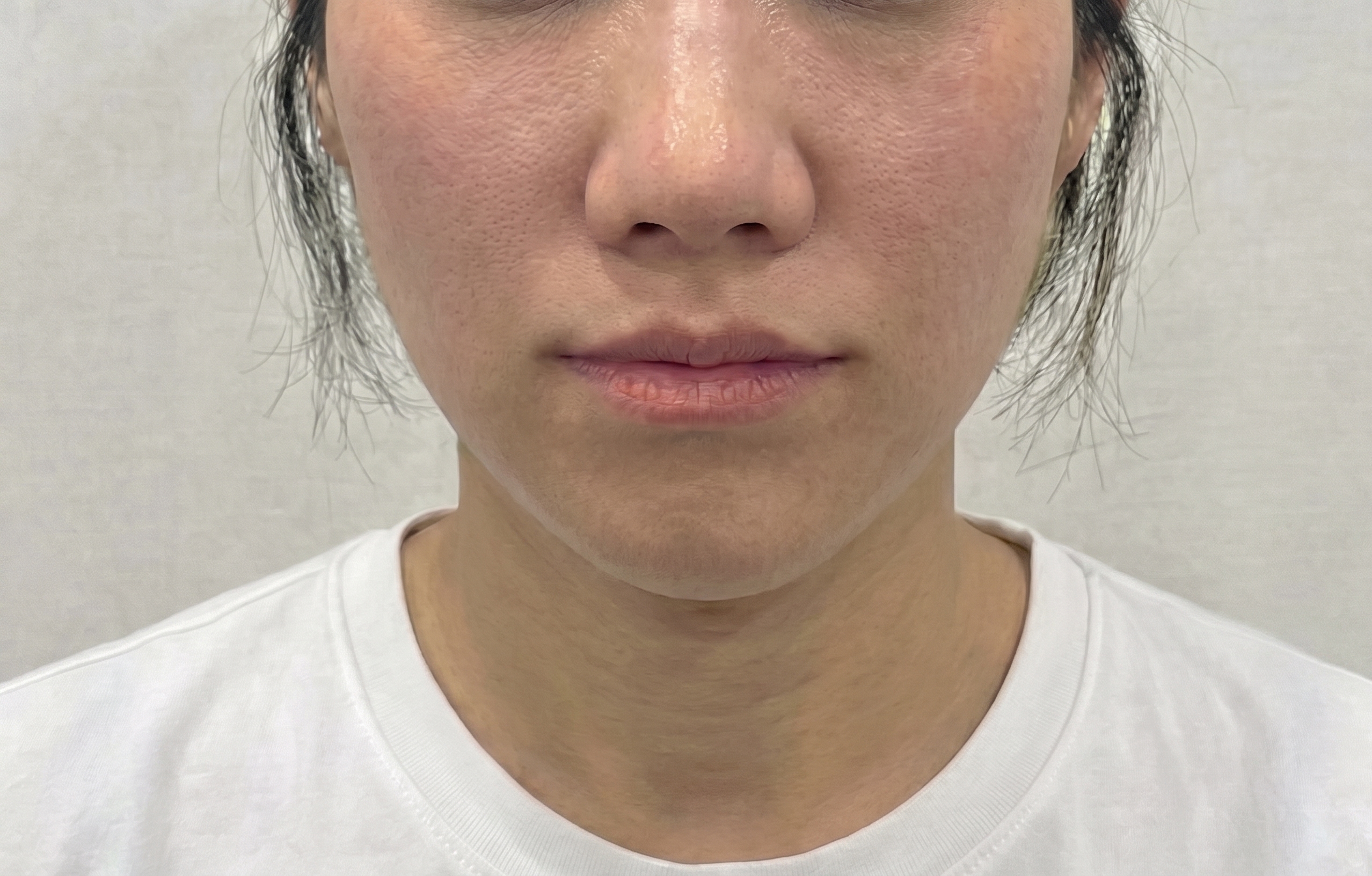After