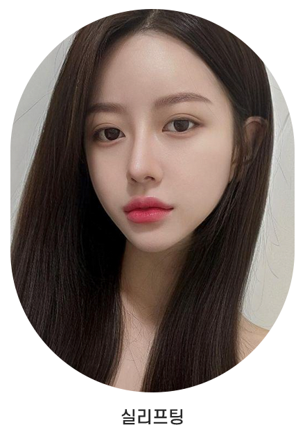 실리프팅