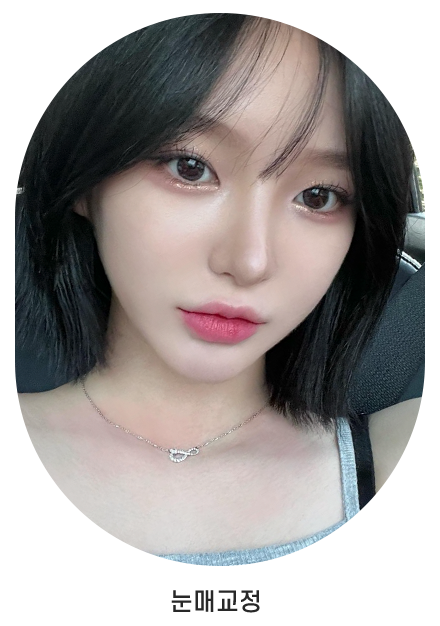 눈매교정