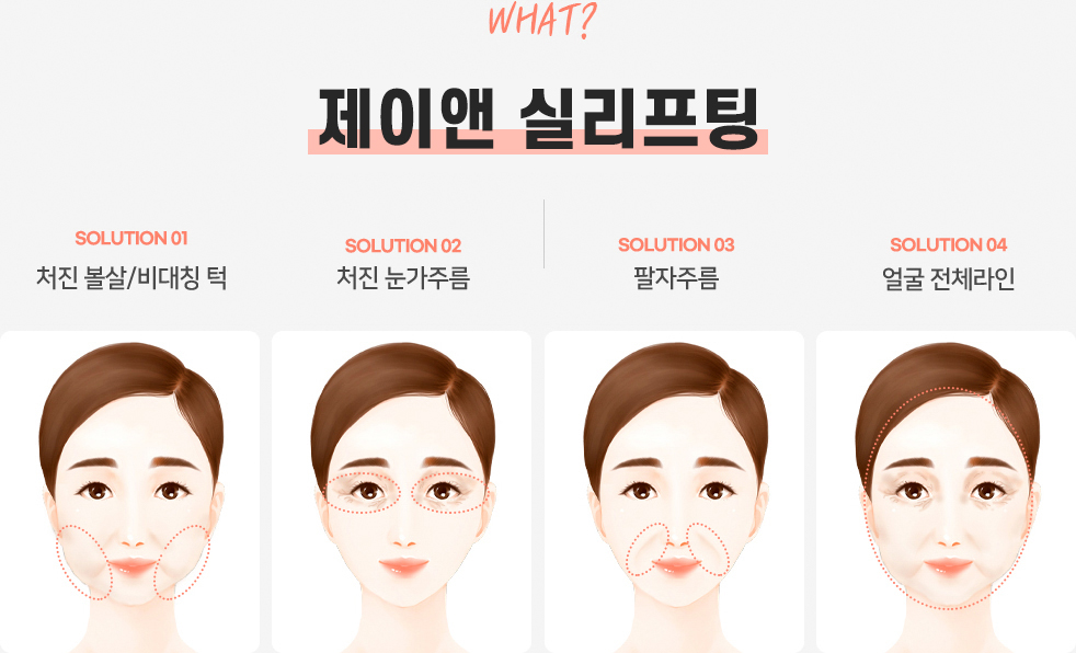실리프팅